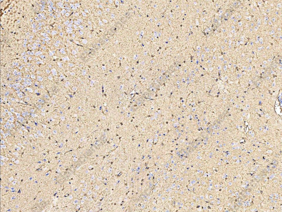 Recombinant S100B Monoclonal Antibody - 2