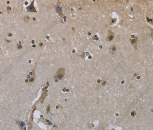 GYS1 Polyclonal Antibody - 2