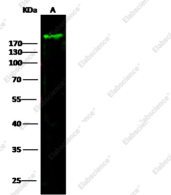 MKI67 Monoclonal Antibody - 2