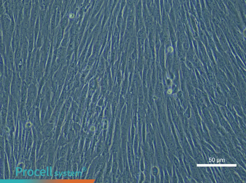 Human Dermal Fibroblast (Primary cell immortalization) Complete Medium - 6