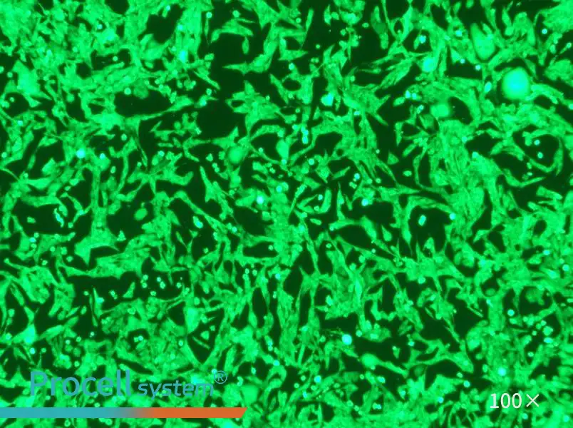 NCI-H446-GFP Cell Complete MediumNCI-H446-GFP Cell Complete Medium - 2