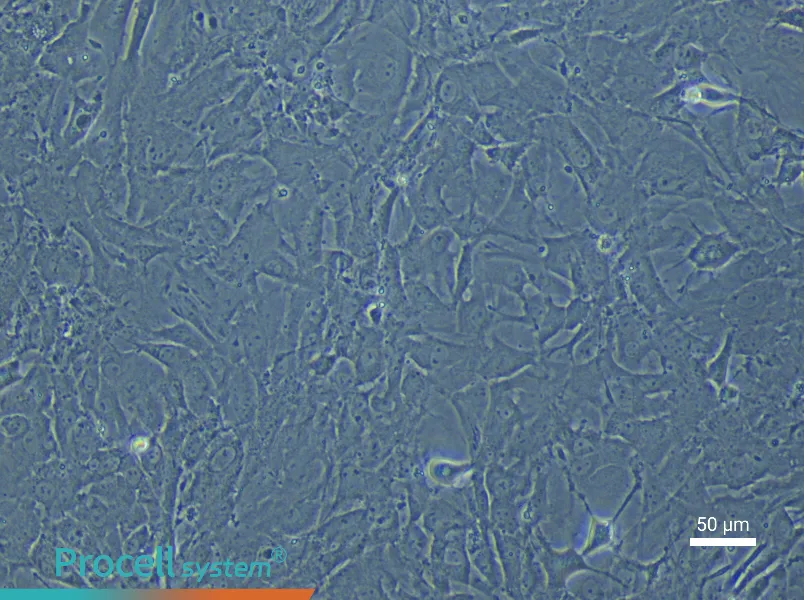 Rat Pulmonary Artery Fibroblast Complete Medium - 6