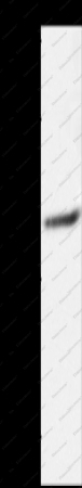 SLC16A4 Polyclonal Antibody - 1