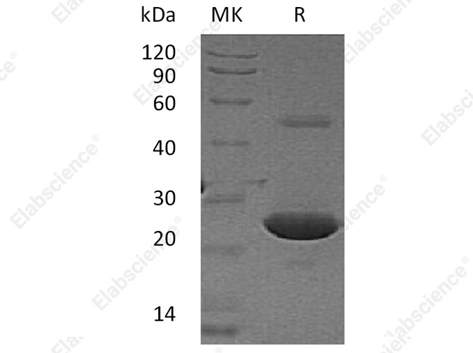 Recombinant Human LYPLA1 Protein (His Tag) - 1