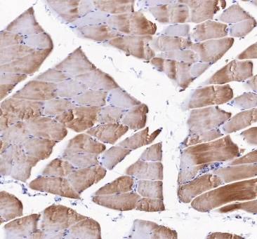 Recombinant Alpha Skeletal Muscle Actin Monoclonal Antibody - small - 4