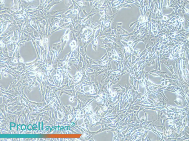 NCI-H1975 Cell Complete Medium - 3