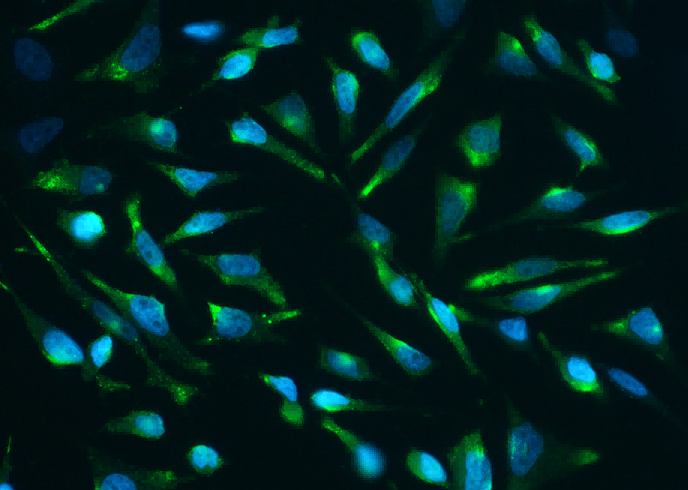 Recombinant Clusterin/Apolipoprotein J/Apo-J Monoclonal Antibody - small - 2