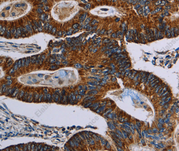 NDUFA4 Polyclonal Antibody - 2