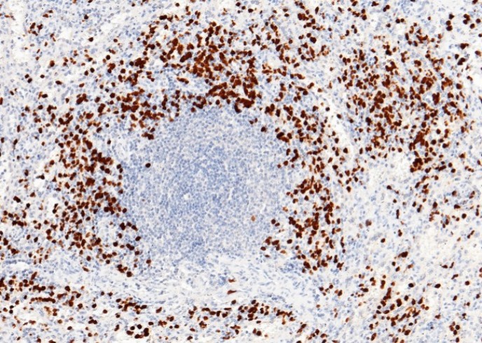 Recombinant S100P Monoclonal Antibody - small - 2