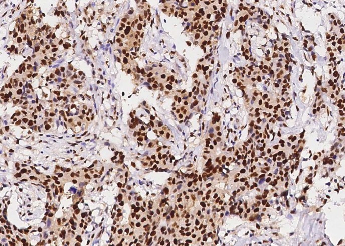 Recombinant PCNA Monoclonal Antibody - small - 2
