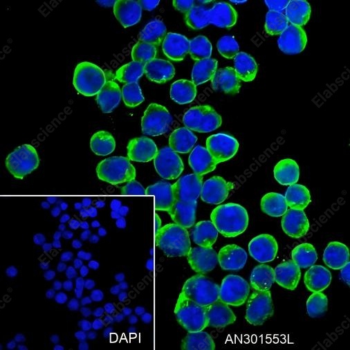 Recombinant HLA-DRB1 Monoclonal Antibody - 3