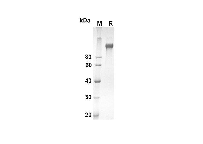 Recombinant Human CDH1 Protein(Sumo Tag)-产品推荐-1