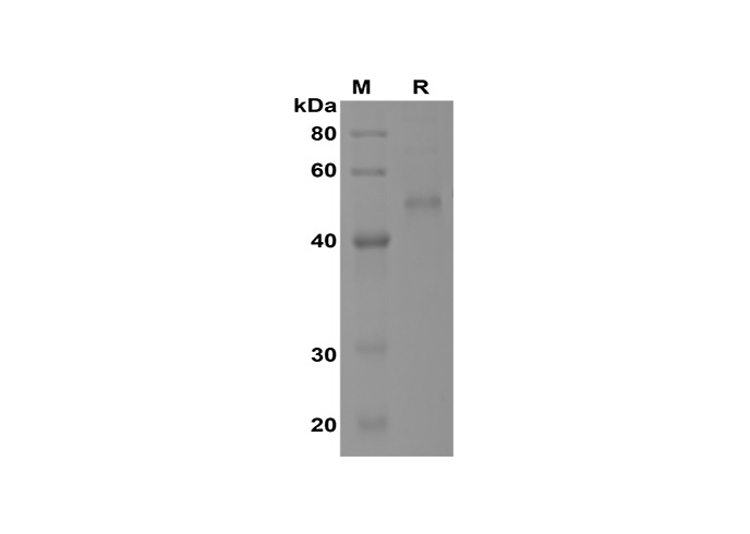 Recombinant Rat IL-1β Protein(hIgG1 Fc Tag)-searchlist-1