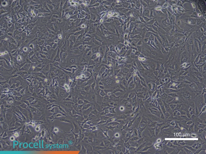 Human Type II Alveolar Epithelial (Primary cell immortalization) Cell Complete Medium - 1