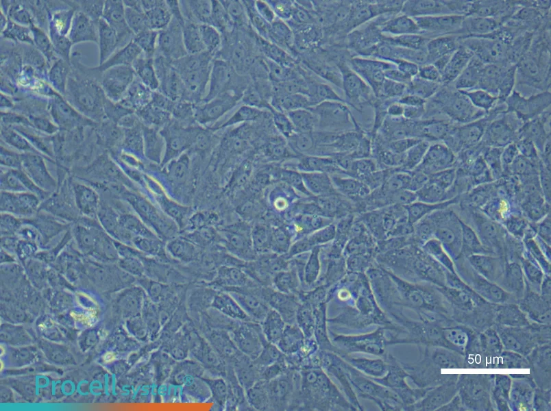 Rat Temporomandibular Joint Chondrocytes - 4