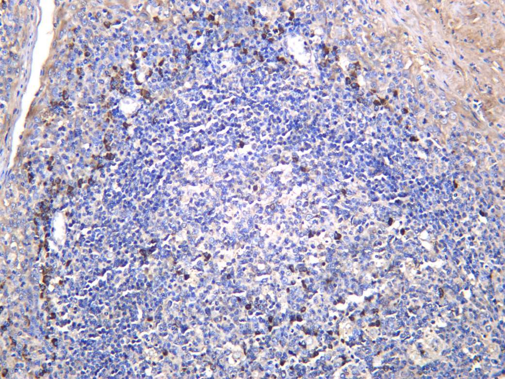 Recombinant AATC Monoclonal Antibody - 2