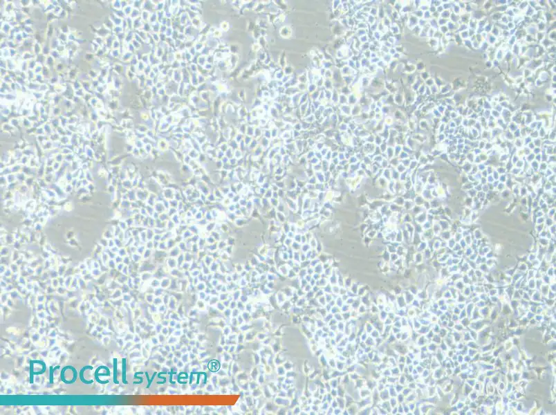 KYSE-180 Cell Complete Medium - 1