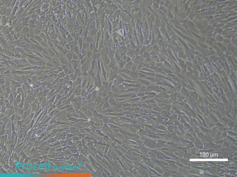 Human Gastric Cancer Fibroblast Complete Medium - 1
