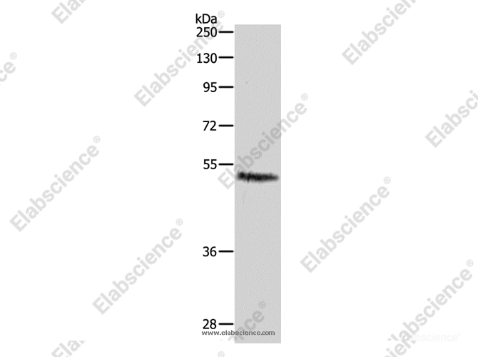 CASP2 Polyclonal Antibody - 1