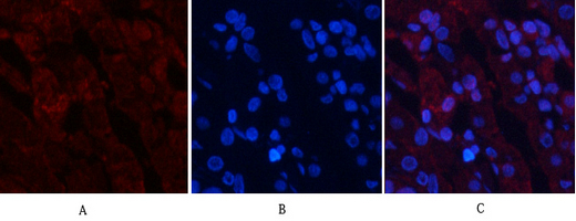 Recombinant Phospho-Akt (Thr308) Monoclonal Antibody - 3