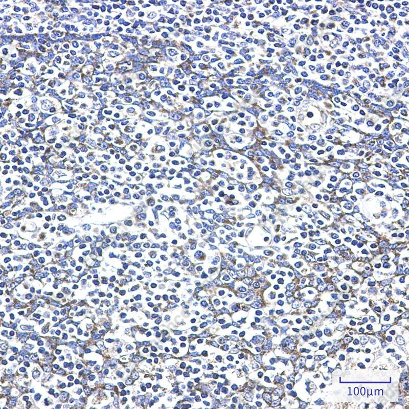 Recombinant AK2/Adenylate kinase 2 Monoclonal Antibody - 3
