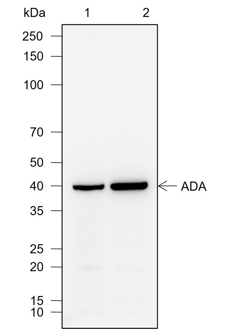 Recombinant ADA Monoclonal Antibody-searchlist-1