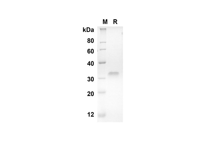 Recombinant Human CD30 Protein(Fc Tag)-产品推荐-1