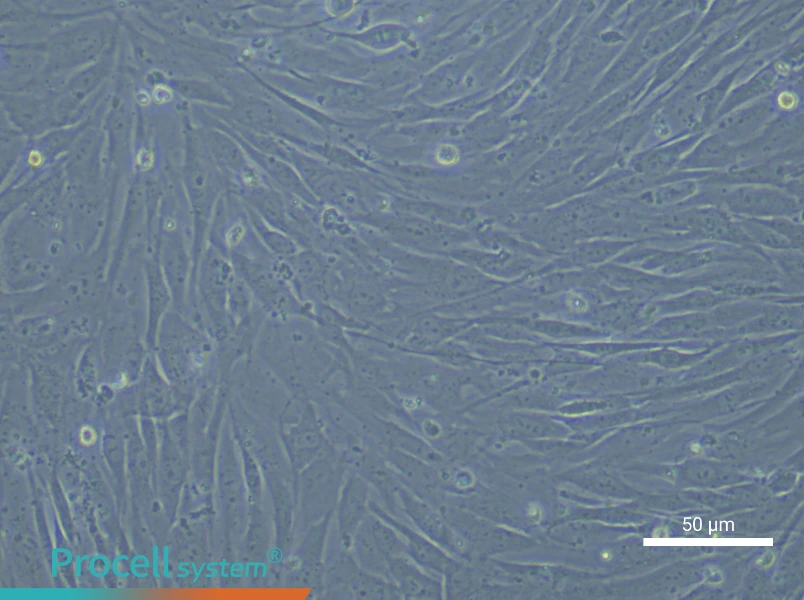 Human Aortic Smooth Muscle (Primary cell immortalization) Cell Complete Medium - 5