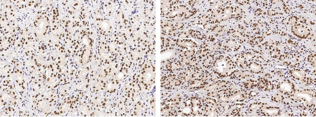 USP7/HAUSP Monoclonal Antibody - small - 1