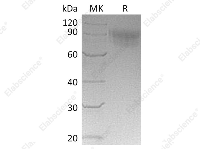 Recombinant Cynomolgus SIGLEC5/CD170 Protein (His Tag) - 1