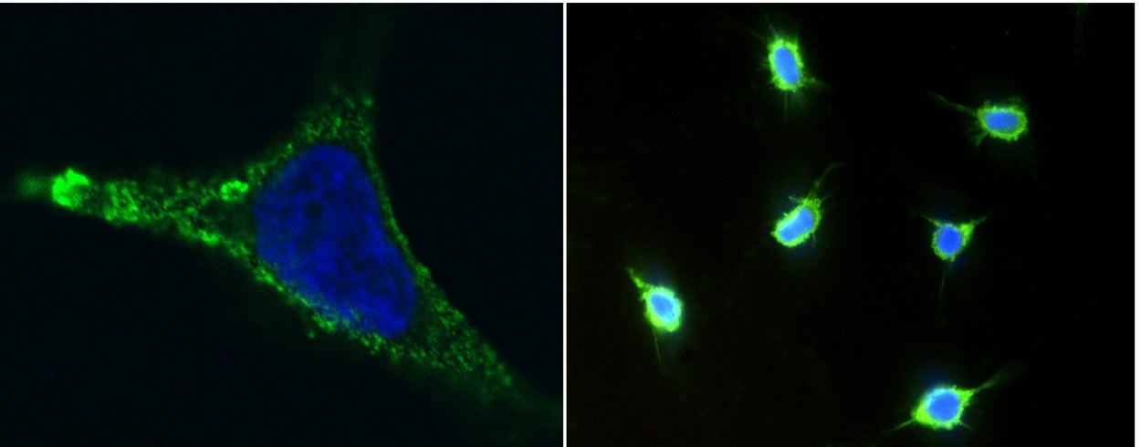 Recombinant CD146/MCAM Monoclonal Antibody - small - 3