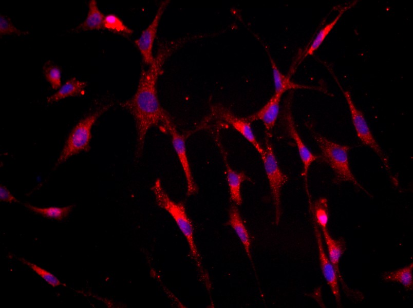 Mouse Articular Chondrocyte Complete MediumMouse Articular Chondrocyte Complete Medium - 2