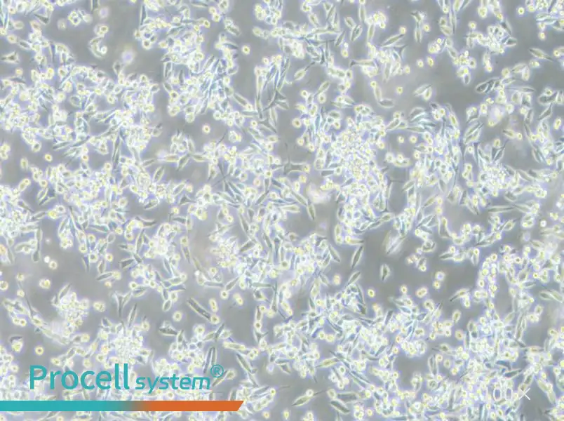 MKN-45 Cell Complete Medium - 2