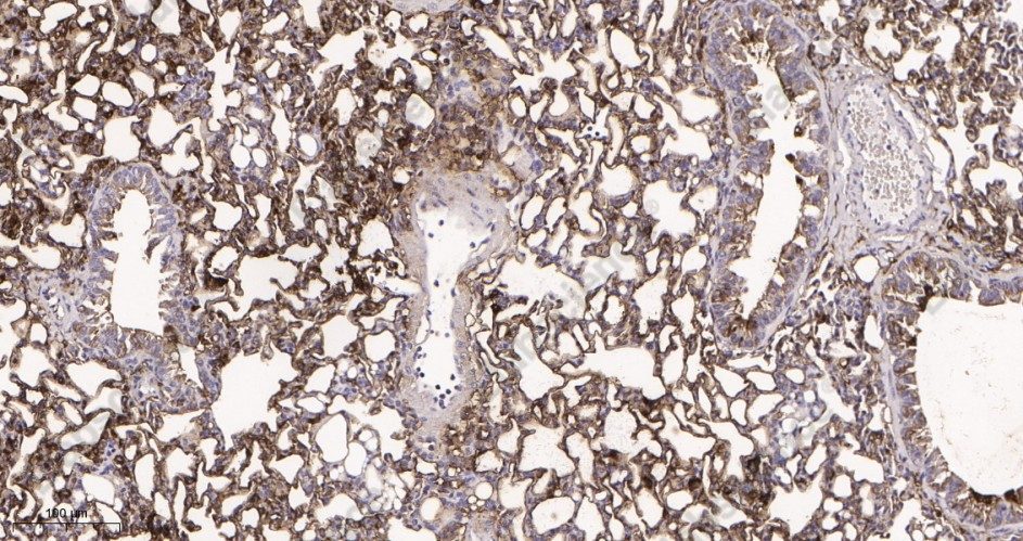 Recombinant PKM Monoclonal Antibody - 3