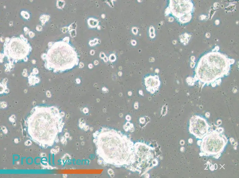 SK-ES-1 Cell Complete Medium - 5