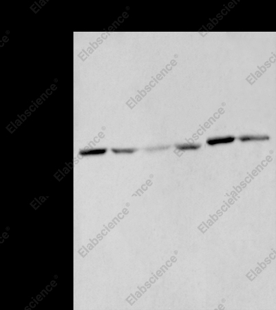 MMP1 Polyclonal Antibody - 1
