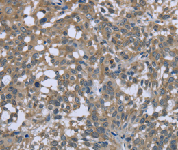 PTK2B Polyclonal Antibody - 3