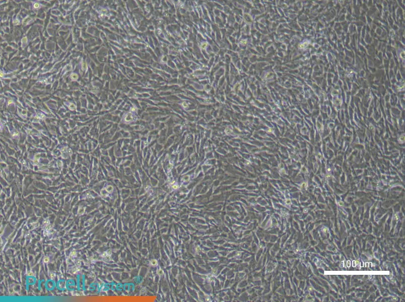 Mouse Bone Marrow Mesenchymal Stem (Primary cell immortalization) Cell Complete Medium - 3