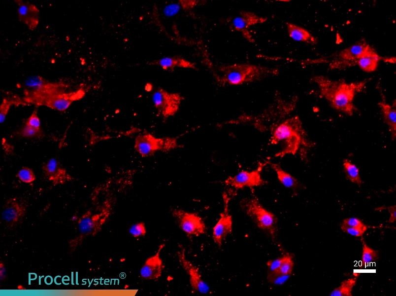 Rat Pulmonary Microvascular Endothelial CellsRat Pulmonary Microvascular Endothelial Cells - 2