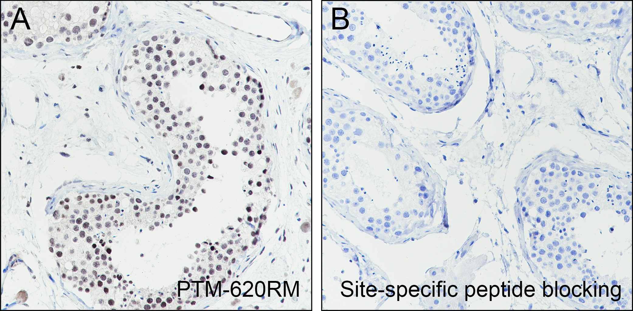 Recombinant Hisotne H3 (Mono Methyl Lys27) Monoclonal Antibody-searchlist-3