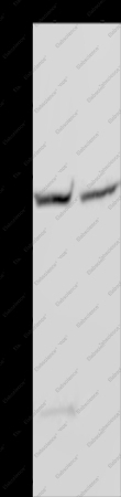 GYS1 Polyclonal Antibody - 1