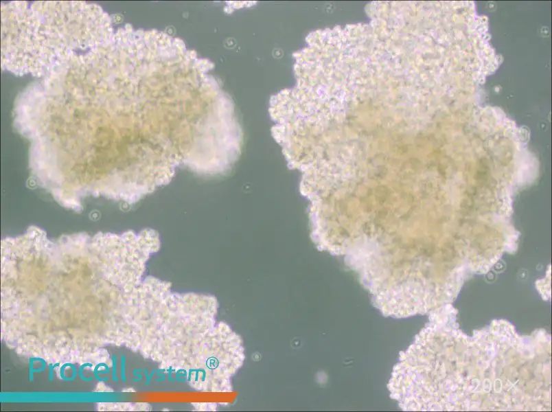 NCI-H146 [H146] Cell Complete Medium - 4