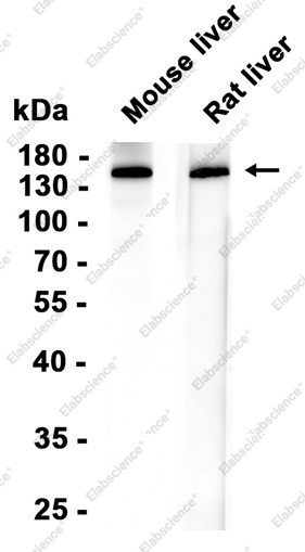 Recombinant NPC1L1 Monoclonal Antibody - 2