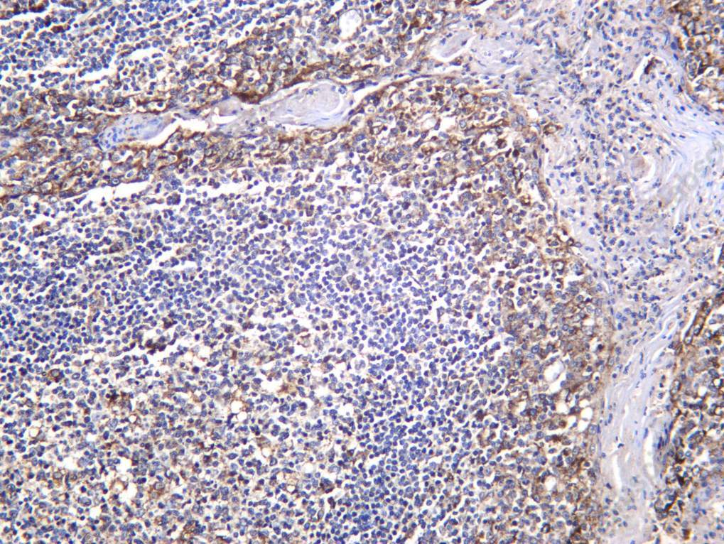 Recombinant SCRB2 Monoclonal Antibody - 2