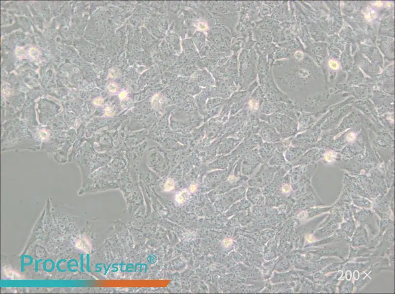 TTA1 Cell Complete Medium - small - 5