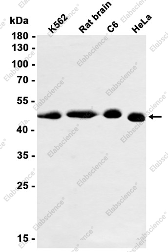 Recombinant SNX5 Monoclonal Antibody - 2