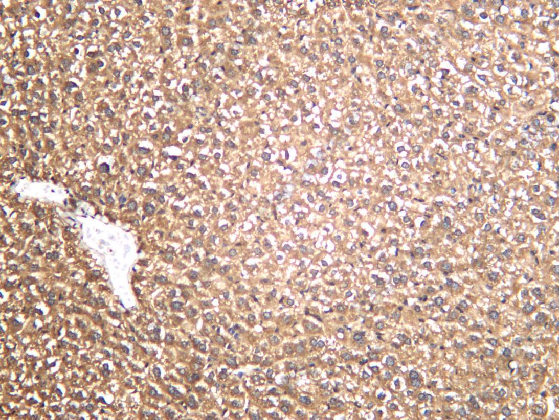 Recombinant L-Lactyl Lysine Monoclonal Antibody - 4
