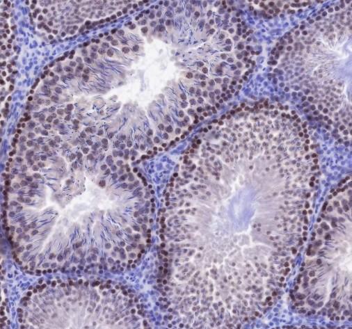 Recombinant SUV39H2 Monoclonal Antibody - 3