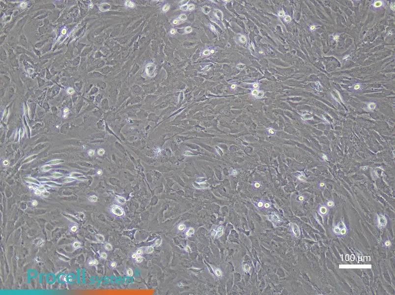 Rat Cerebral Artery Smooth Muscle Cell Complete Medium - 3