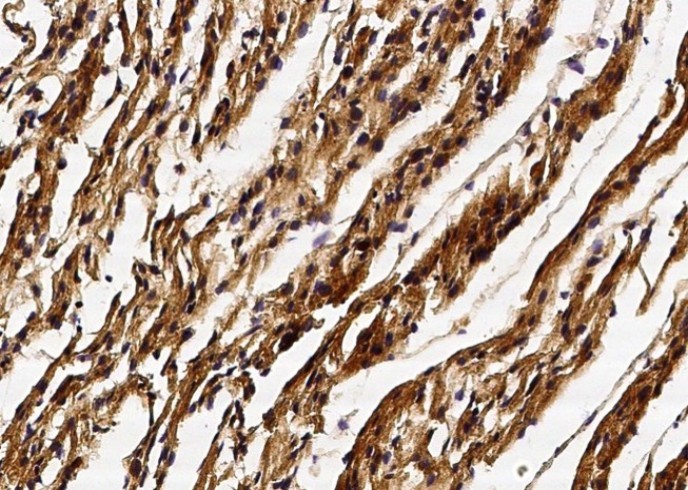 Recombinant GSTM2 Monoclonal Antibody - small - 2